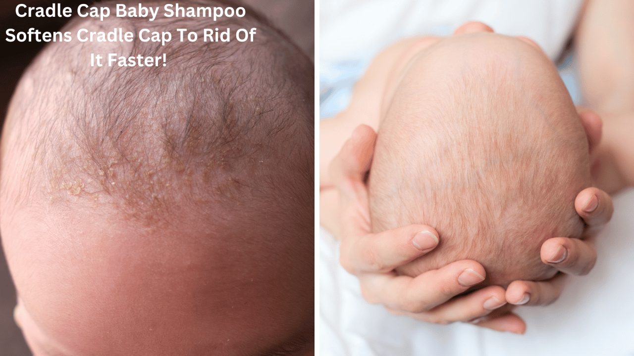 The "Top 5" Test: The Best Shampoo For Cradle Cap Revealed!